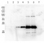 cFBPase | Cytosolic fructose-1,6-bisphosphatase (cytoplasm marker in photosynthetic tissues)